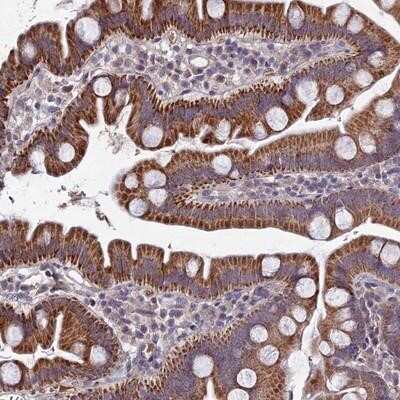 Immunohistochemistry-Paraffin: Carbohydrate Sulfotransferase 5/CHST5 Antibody [NBP1-91785]