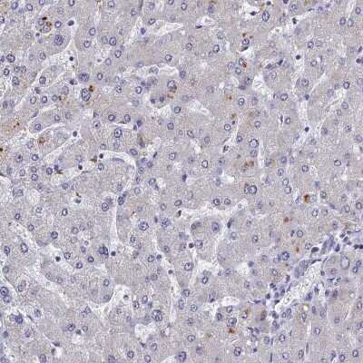 Immunohistochemistry-Paraffin: Carbohydrate Sulfotransferase 5/CHST5 Antibody [NBP1-91785]