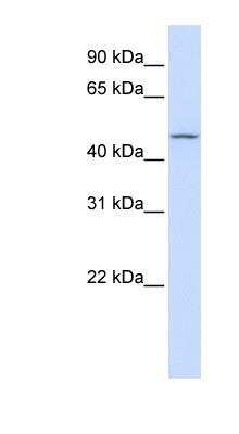 Western Blot: Carbohydrate Sulfotransferase 6/CHST6 Antibody [NBP1-57928]
