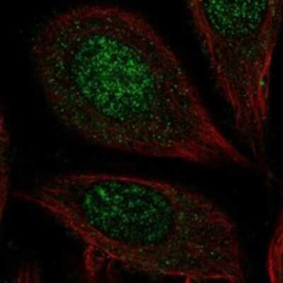 Immunocytochemistry/ Immunofluorescence: Carbohydrate Sulfotransferase 7/CHST7 Antibody [NBP3-17222]