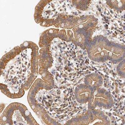 Immunohistochemistry: Carbohydrate Sulfotransferase 7/CHST7 Antibody [NBP1-91248]