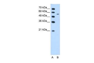 Western Blot: Carbohydrate Sulfotransferase 7/CHST7 Antibody [NBP2-87122]