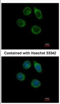 Immunocytochemistry/ Immunofluorescence: Carbohydrate Sulfotransferase 2/CHST2 Antibody [NBP2-15696]
