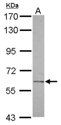 Western Blot: Carbohydrate Sulfotransferase 2/CHST2 Antibody [NBP2-15696]