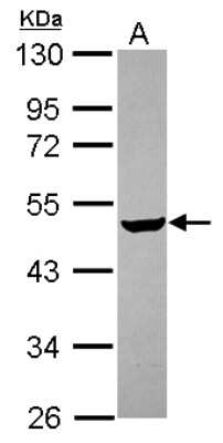 Western Blot: Carbohydrate Sulfotransferase 4/CHST4 Antibody [NBP2-15697]