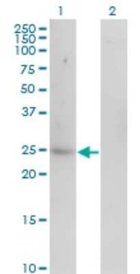 Western Blot: Carbonic Anhydrase I/CA1 Antibody (7G12) [H00000759-M07]