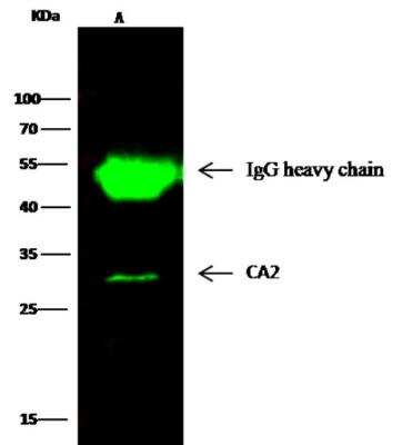 Immunoprecipitation: Carbonic Anhydrase II/CA2 Antibody (001) [NBP2-89522]