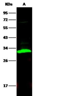 Western Blot: Carbonic Anhydrase II/CA2 Antibody (001) [NBP2-89522]
