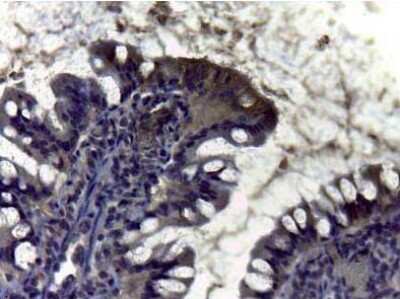 Immunohistochemistry: Carbonic Anhydrase II/CA2 Antibody [NB600-943]