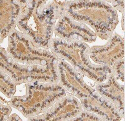 Immunohistochemistry-Paraffin: Carbonic Anhydrase II/CA2 Antibody [NBP2-52736]