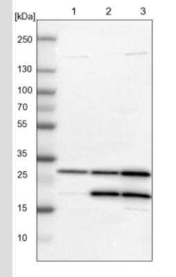 Western Blot: Carbonic Anhydrase II/CA2 Antibody [NBP2-52736]