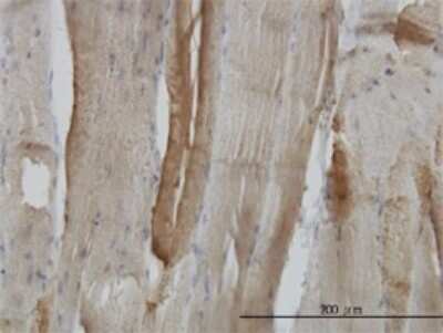 Immunohistochemistry-Paraffin: Carbonic Anhydrase III/CA3 Antibody (4A12-1A3) [H00000761-M02]