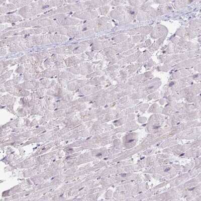 Immunohistochemistry-Paraffin: Carbonic Anhydrase III/CA3 Antibody [NBP1-88227]
