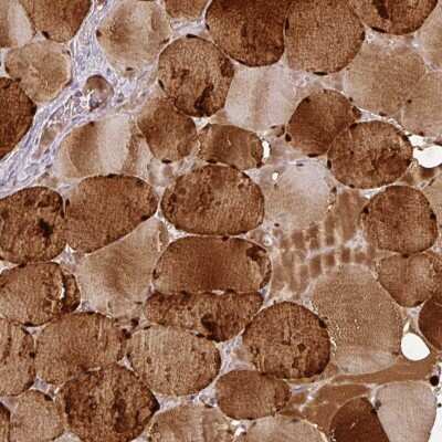 Immunohistochemistry-Paraffin: Carbonic Anhydrase III/CA3 Antibody [NBP1-88227]