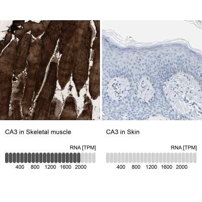 Immunohistochemistry-Paraffin: Carbonic Anhydrase III/CA3 Antibody [NBP1-88228]