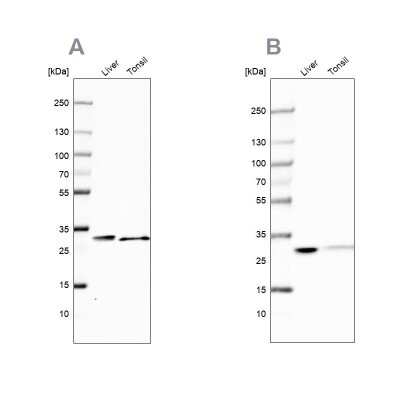 Western Blot: Carbonic Anhydrase III/CA3 Antibody [NBP1-88227]