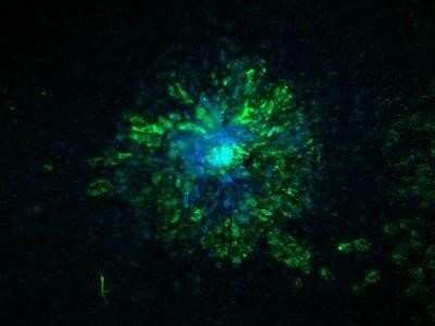 Immunocytochemistry/ Immunofluorescence: Carbonic Anhydrase IX/CA9 Antibody (2D3) - Azide and BSA Free [NBP2-80611]