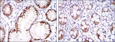 Immunohistochemistry-Paraffin: Carbonic Anhydrase IX/CA9 Antibody (2D3) - BSA Free [NBP1-51691]