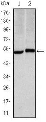 Western Blot: Carbonic Anhydrase IX/CA9 Antibody (2D3)BSA Free [NBP1-51691]