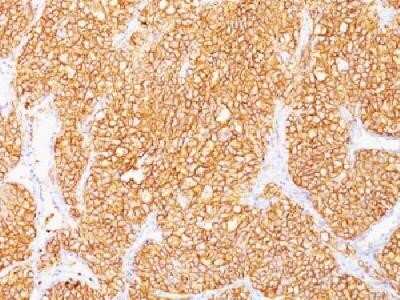 Immunohistochemistry-Paraffin: Carbonic Anhydrase IX/CA9 Antibody (SPM314) - Azide and BSA Free [NBP2-34408]