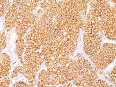 Immunohistochemistry-Paraffin: Carbonic Anhydrase IX/CA9 Antibody (SPM314) [NBP2-34360]