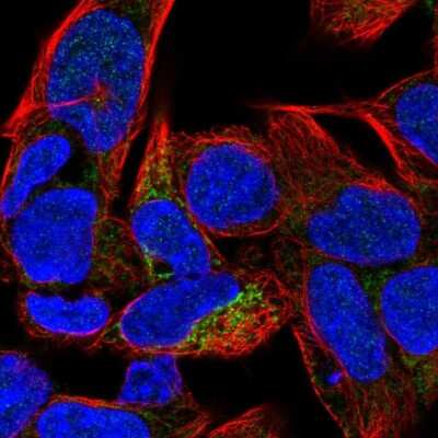 Immunocytochemistry/ Immunofluorescence: Carbonic Anhydrase VB/CA5B Antibody [NBP1-86090]