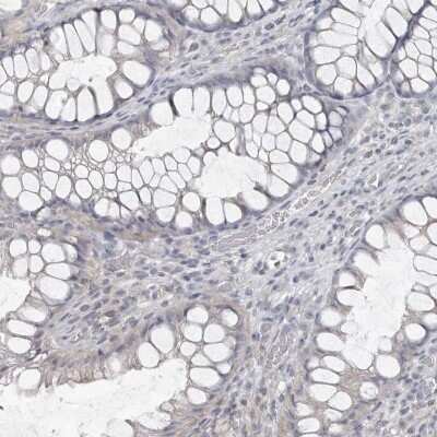 Immunohistochemistry-Paraffin: Carbonic Anhydrase VI Antibody [NBP1-87536]