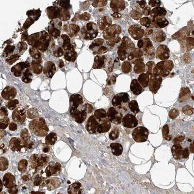 Immunohistochemistry-Paraffin: Carbonic Anhydrase VI Antibody [NBP1-87536]
