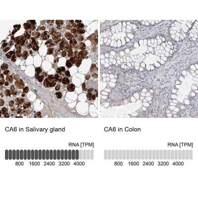 Immunohistochemistry-Paraffin: Carbonic Anhydrase VI Antibody [NBP1-87536]