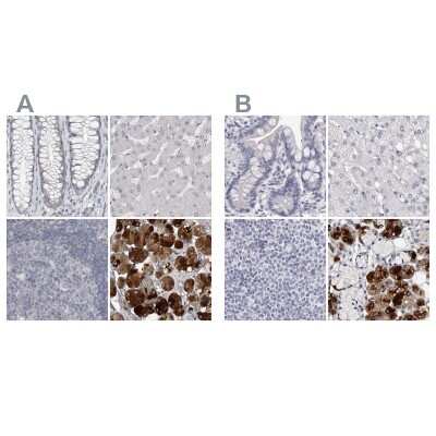 Immunohistochemistry-Paraffin: Carbonic Anhydrase VI Antibody [NBP1-87536]