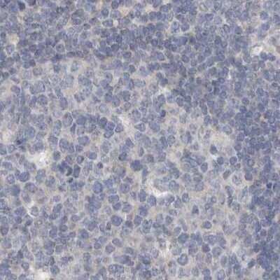 Immunohistochemistry-Paraffin: Carbonic Anhydrase VI Antibody [NBP1-87536]