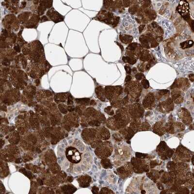 Immunohistochemistry-Paraffin: Carbonic Anhydrase VI Antibody [NBP1-87537]