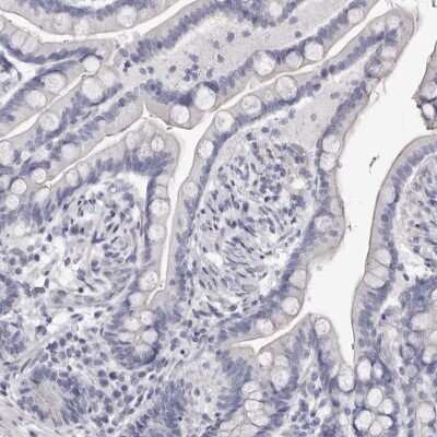 Immunohistochemistry-Paraffin: Carbonic Anhydrase VI Antibody [NBP1-87537]
