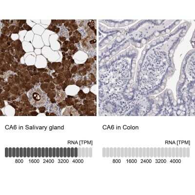Immunohistochemistry-Paraffin: Carbonic Anhydrase VI Antibody [NBP1-87537]