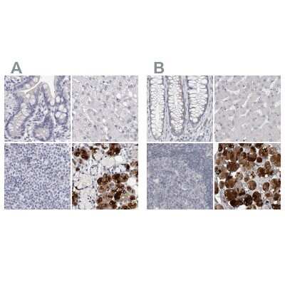 Immunohistochemistry-Paraffin: Carbonic Anhydrase VI Antibody [NBP1-87537]