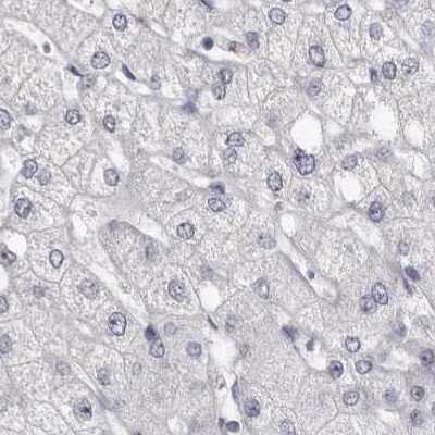 Immunohistochemistry-Paraffin: Carbonic Anhydrase VI Antibody [NBP1-87537]