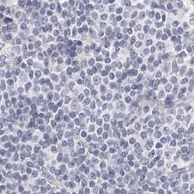 Immunohistochemistry-Paraffin: Carbonic Anhydrase VI Antibody [NBP1-87537]