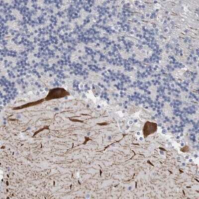 Immunohistochemistry-Paraffin: Carbonic Anhydrase VIII/CA8 Antibody [NBP1-86654]