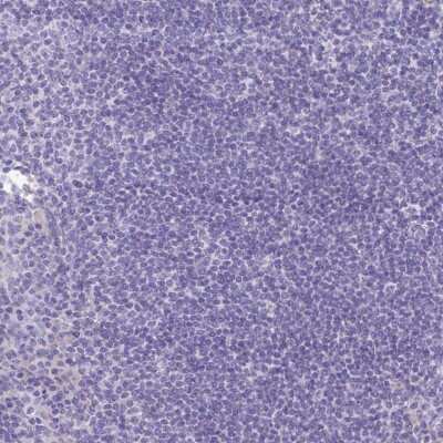 Immunohistochemistry-Paraffin: Carbonic Anhydrase X/CA10 Antibody [NBP2-31586]