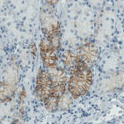 Immunohistochemistry-Paraffin: Carbonic Anhydrase XII/CA12 Antibody (CL0278) [NBP2-52901]