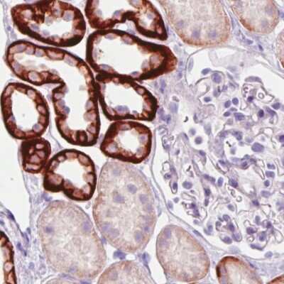 Immunohistochemistry-Paraffin: Carbonic Anhydrase XII/CA12 Antibody (CL0280) [NBP2-52902]