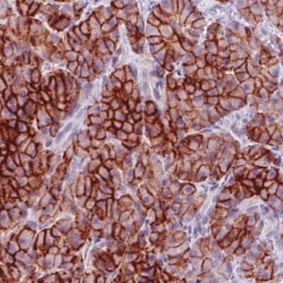 Immunohistochemistry-Paraffin: Carbonic Anhydrase XII/CA12 Antibody (CL0280) [NBP2-52902]
