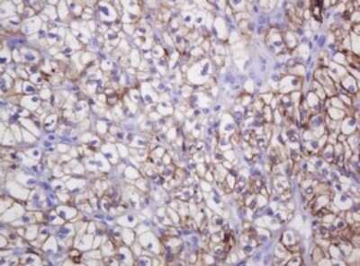 Immunohistochemistry: Carbonic Anhydrase XII/CA12 Antibody (OTI2C6) - Azide and BSA Free [NBP2-70329]