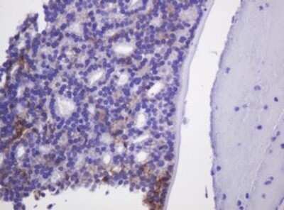 Immunohistochemistry: Carbonic Anhydrase XII/CA12 Antibody (OTI2C6) - Azide and BSA Free [NBP2-70329]