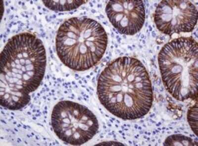 Immunohistochemistry: Carbonic Anhydrase XII/CA12 Antibody (OTI2C6) - Azide and BSA Free [NBP2-70329]