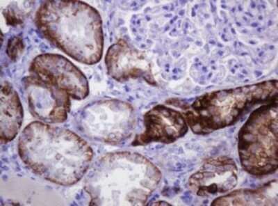 Immunohistochemistry: Carbonic Anhydrase XII/CA12 Antibody (OTI2C6) - Azide and BSA Free [NBP2-70329]