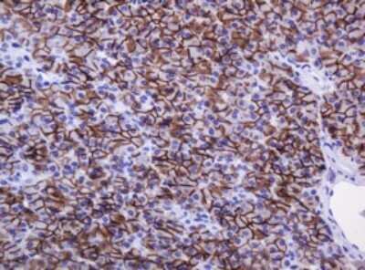 Immunohistochemistry: Carbonic Anhydrase XII/CA12 Antibody (OTI2C6) - Azide and BSA Free [NBP2-70329]
