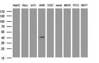 Western Blot: Carbonic Anhydrase XII/CA12 Antibody (OTI2C6)Azide and BSA Free [NBP2-70329]