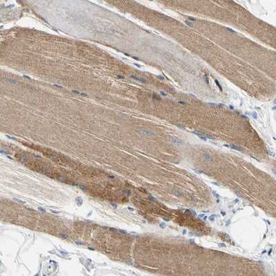 Immunohistochemistry-Paraffin: Carbonic Anhydrase XIV/CA14 Antibody [NBP1-87477]