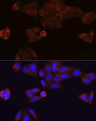 Immunocytochemistry/ Immunofluorescence: Carboxylesterase 1/CES1 Antibody (7C9R6) [NBP3-15388]
